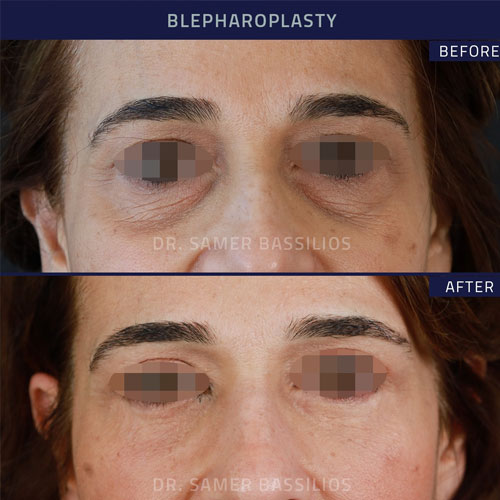 Follow us on Instagram