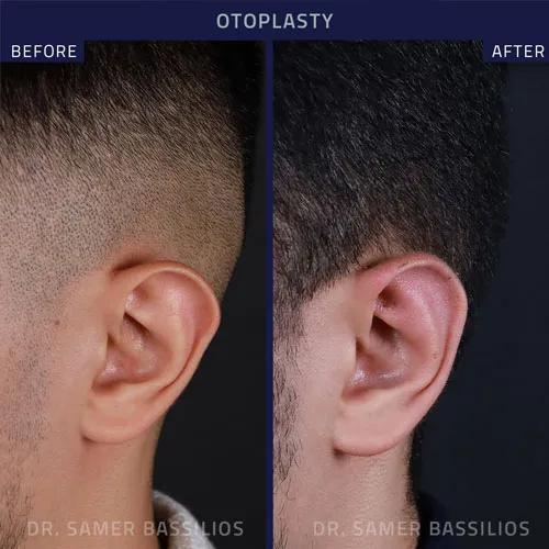 Follow us on Instagram