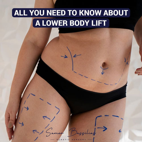 Follow us on Instagram