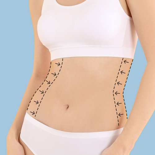 https://www.drsamerbassilios.com/images/services/after-weightloss-body-contouring.jpg