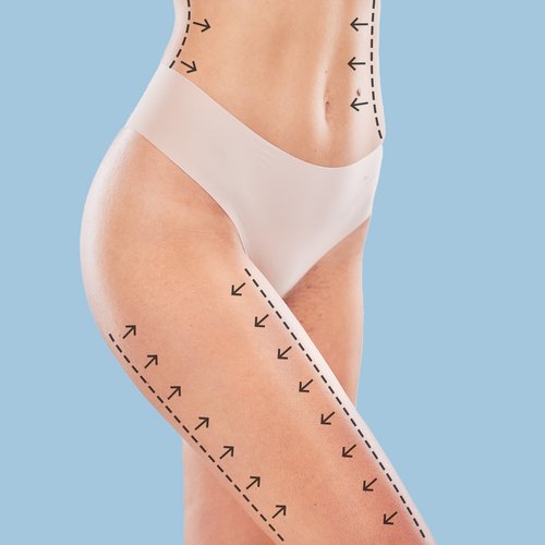 https://www.drsamerbassilios.com/images/services/body-liposuction.jpg