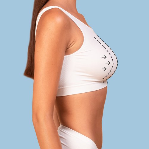https://www.drsamerbassilios.com/images/services/breast-augmentation.jpg