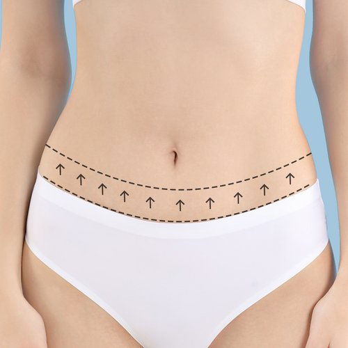 https://www.drsamerbassilios.com/images/services/tummy-tuck.jpg