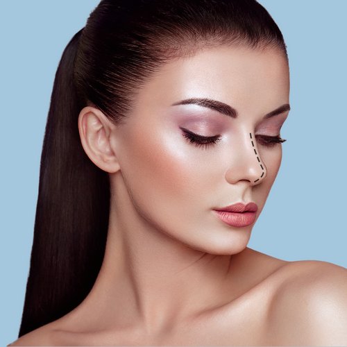 https://www.drsamerbassilios.com/images/services/ultrasonic-rhinoplasty.jpg